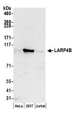 LARP4B Polyclonal Antibody