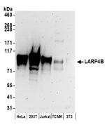 LARP4B Polyclonal Antibody