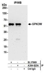GPKOW Antibody in Immunoprecipitation (IP)