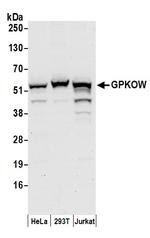 GPKOW Antibody in Western Blot (WB)