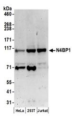 N4BP1 Polyclonal Antibody