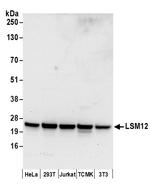 LSM12 Antibody in Western Blot (WB)