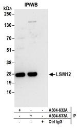 LSM12 Antibody in Immunoprecipitation (IP)