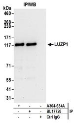 LUZP1 Antibody in Immunoprecipitation (IP)