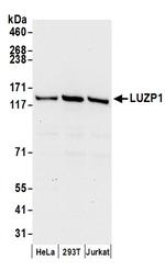 LUZP1 Polyclonal Antibody