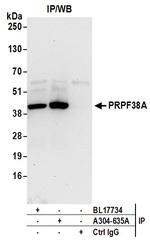 PRPF38A Antibody in Immunoprecipitation (IP)