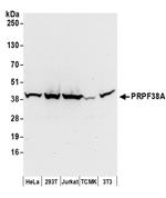 PRPF38A Antibody in Western Blot (WB)