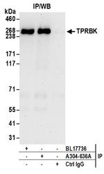 TPRBK Antibody in Immunoprecipitation (IP)