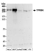 TPRBK Polyclonal Antibody