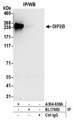 DIP2B Antibody in Immunoprecipitation (IP)