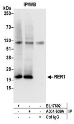 RER1 Antibody in Immunoprecipitation (IP)