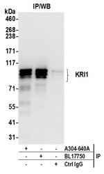 KRI1 Antibody in Immunoprecipitation (IP)