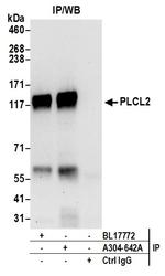 PLCL2 Antibody in Immunoprecipitation (IP)