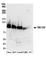 TBC1D5 Polyclonal Antibody