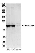 KIAA1598 Polyclonal Antibody