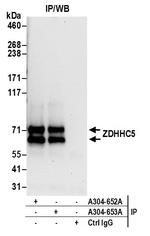 ZDHHC5 Antibody in Immunoprecipitation (IP)