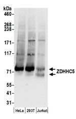ZDHHC5 Polyclonal Antibody