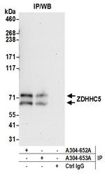 ZDHHC5 Polyclonal Antibody