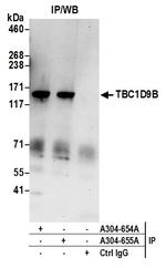 TBC1D9B Polyclonal Antibody