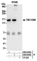 TBC1D9B Antibody in Immunoprecipitation (IP)