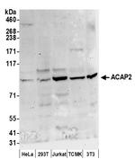 ACAP2 Polyclonal Antibody