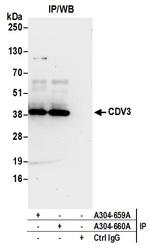 CDV3 Antibody in Immunoprecipitation (IP)