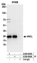 HN1L Antibody in Immunoprecipitation (IP)
