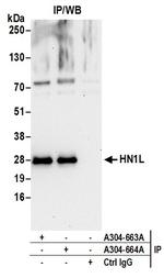HN1L Antibody in Immunoprecipitation (IP)