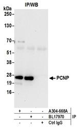 PCNP Antibody in Immunoprecipitation (IP)