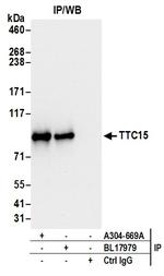 TTC15 Antibody in Immunoprecipitation (IP)