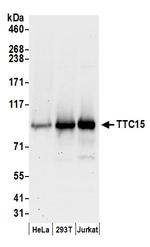 TTC15 Polyclonal Antibody