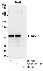 SUGP1 Antibody in Immunoprecipitation (IP)