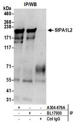 SIPA1L2 Polyclonal Antibody