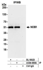 NOB1 Antibody in Immunoprecipitation (IP)