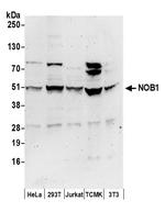 NOB1 Antibody in Western Blot (WB)