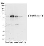 DNA Helicase B Polyclonal Antibody