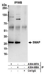 SMAP Antibody in Immunoprecipitation (IP)