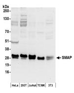 SMAP Polyclonal Antibody