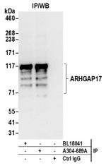 ARHGAP17 Antibody in Immunoprecipitation (IP)