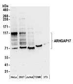 ARHGAP17 Polyclonal Antibody