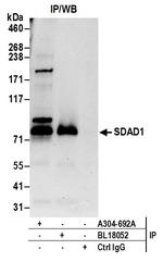SDAD1 Polyclonal Antibody