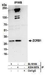 ZCRB1 Antibody in Immunoprecipitation (IP)