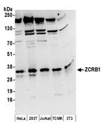 ZCRB1 Polyclonal Antibody