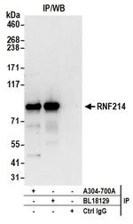 RNF214 Antibody in Immunoprecipitation (IP)