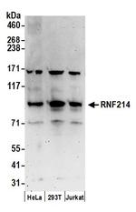 RNF214 Polyclonal Antibody
