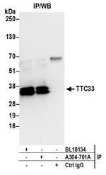 TTC33 Antibody in Immunoprecipitation (IP)