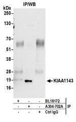 KIAA1143 Antibody in Immunoprecipitation (IP)
