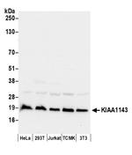 KIAA1143 Polyclonal Antibody