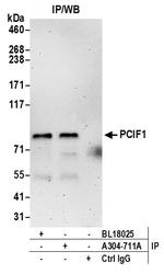 PCIF1 Antibody in Immunoprecipitation (IP)