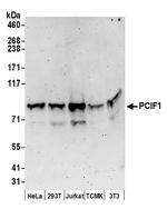 PCIF1 Polyclonal Antibody